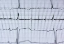 cyber node stellar pulse 951230587